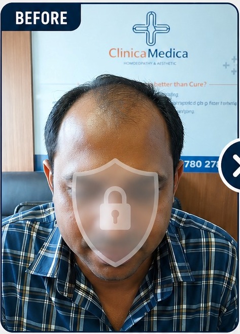 Before advanced hair growth treatment