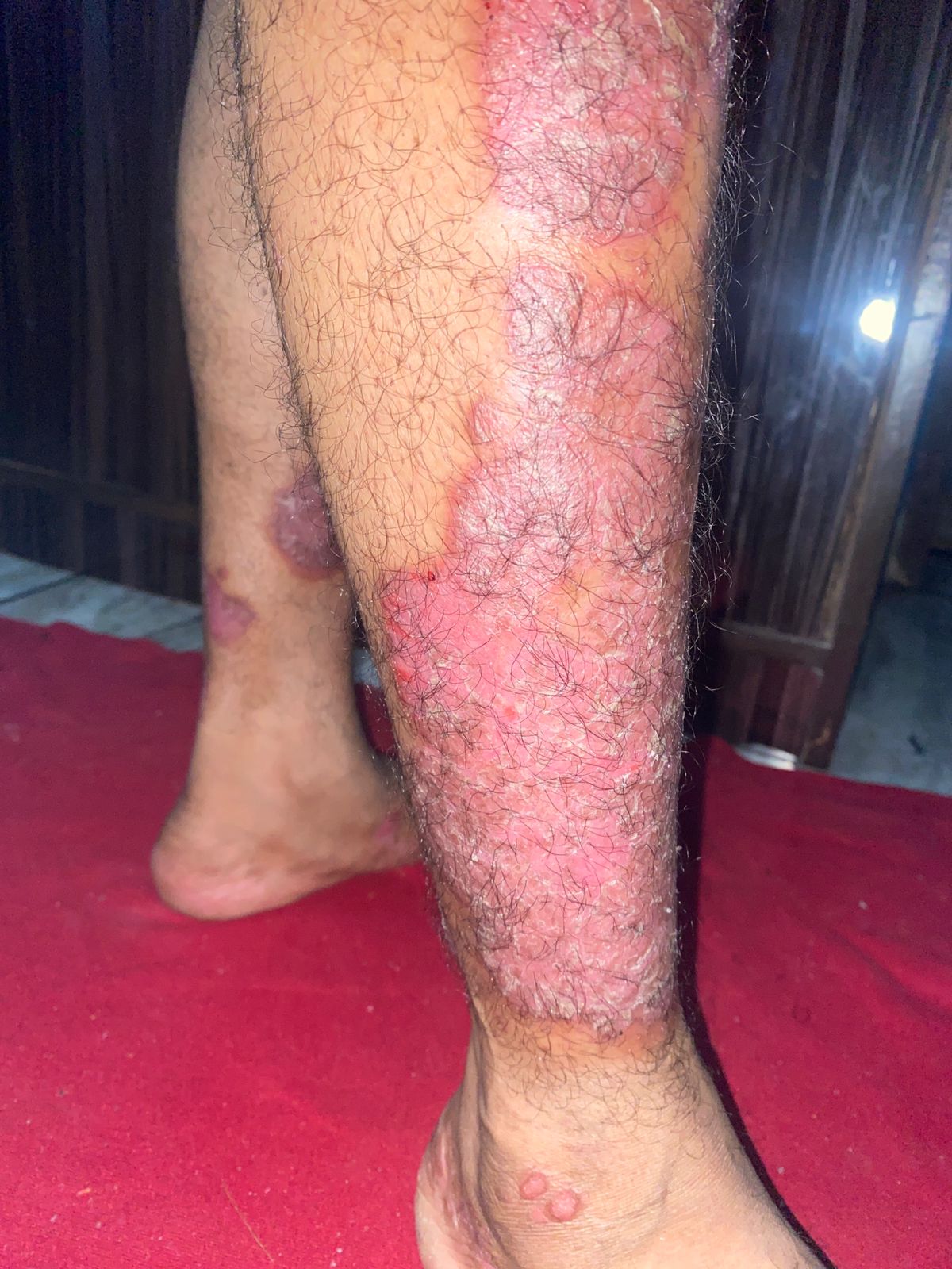 Before homeopathic skin care treatment