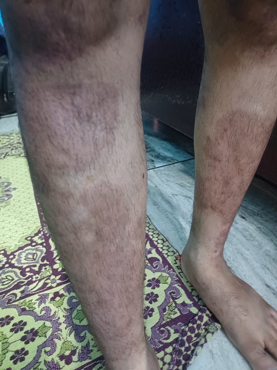 Homeopathic skin care treatment result